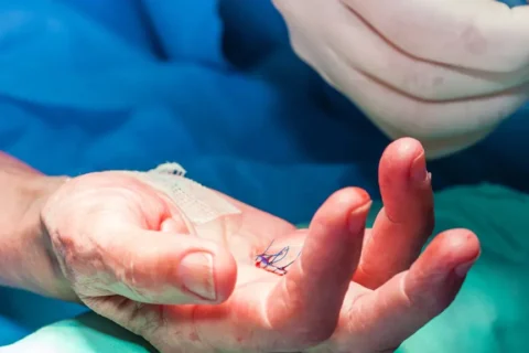 Hand and Peripheral Surgery